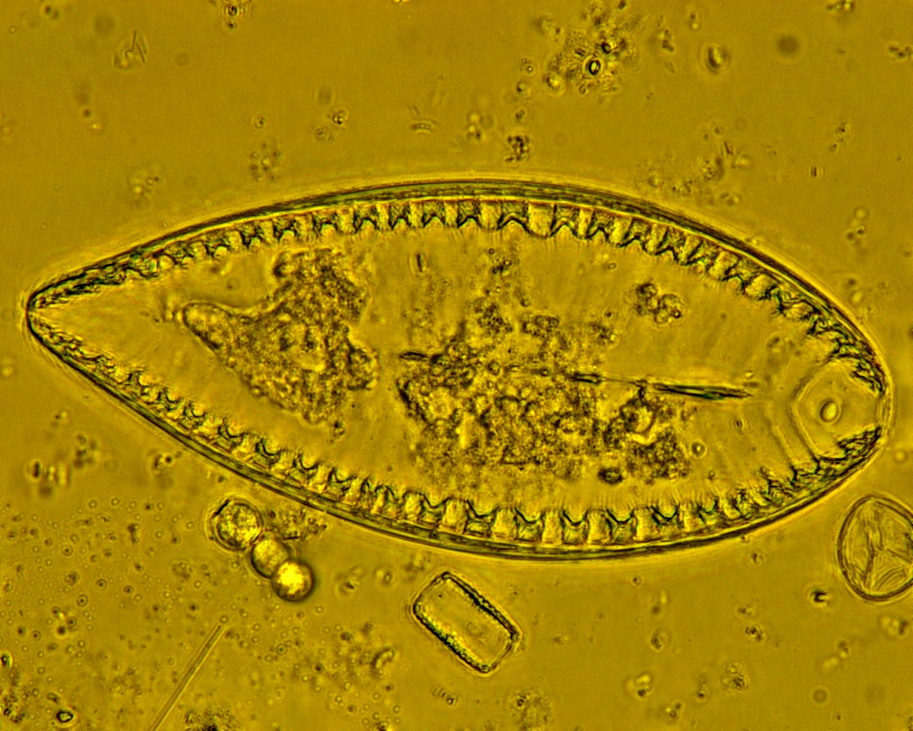 Dictyocha speculum